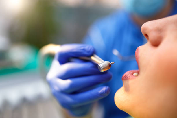 Dental Bonding in Frankfort, OH